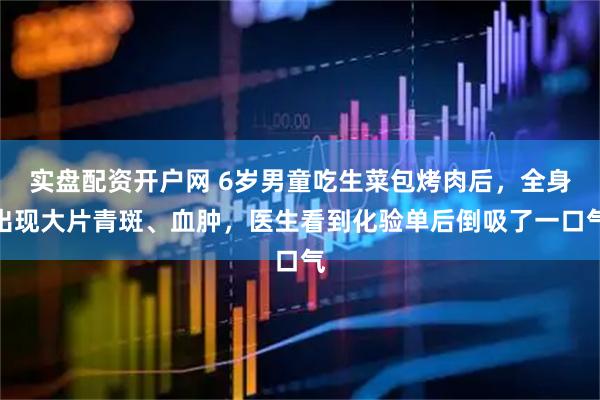 实盘配资开户网 6岁男童吃生菜包烤肉后，全身出现大片青斑、血肿，医生看到化验单后倒吸了一口气
